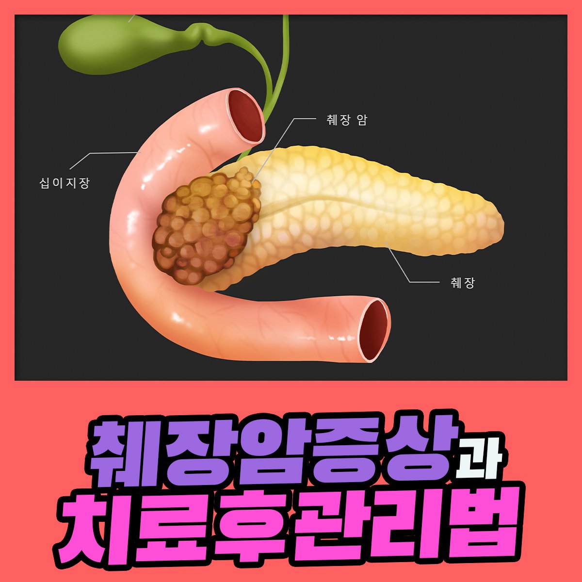 췌장암의 침묵, 그리고 절망