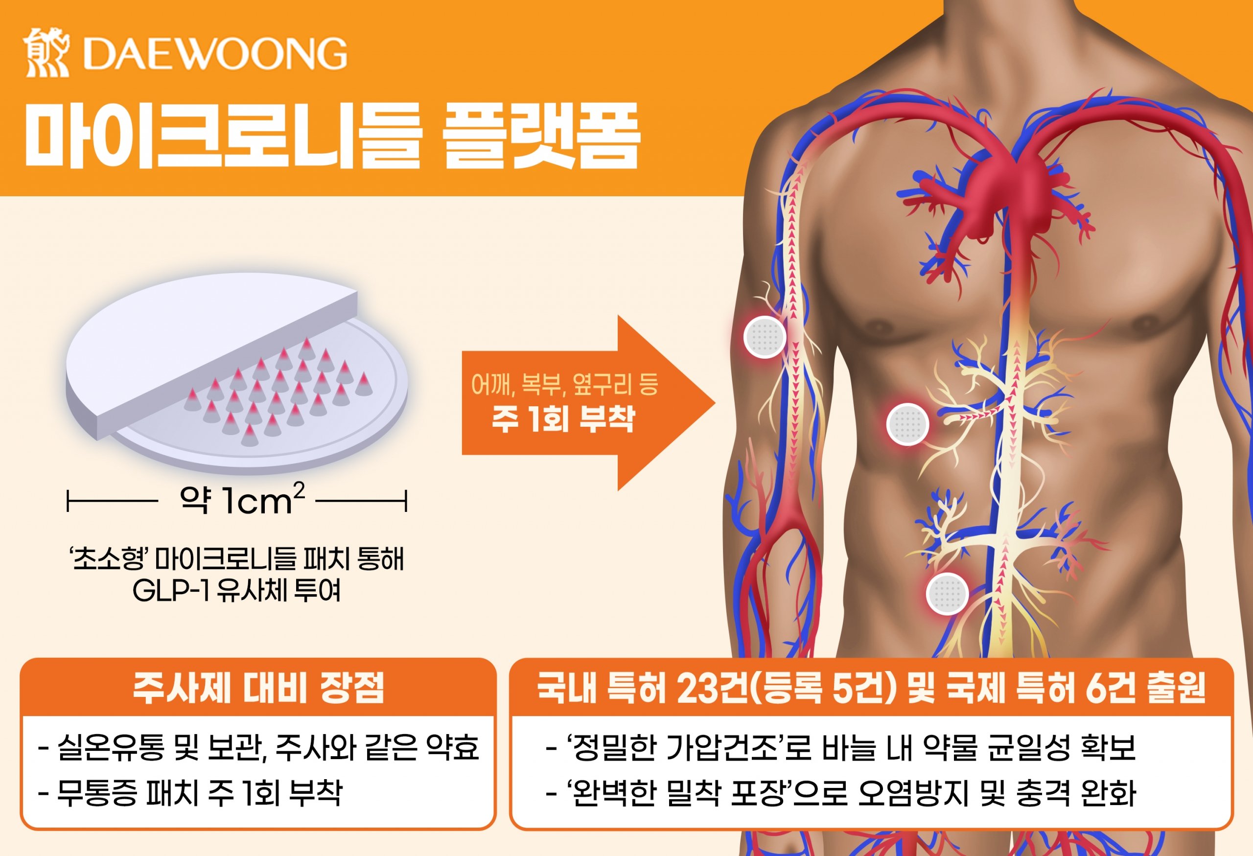 위고비에 숨겨진 위험, 부작용